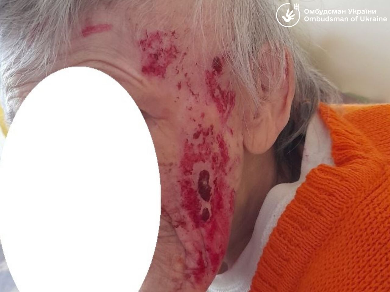 Без доступу до питної води і власних грошей: геріатричний пансіонат у Львові потрапив у скандал